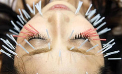 全球各種“奇葩療法”